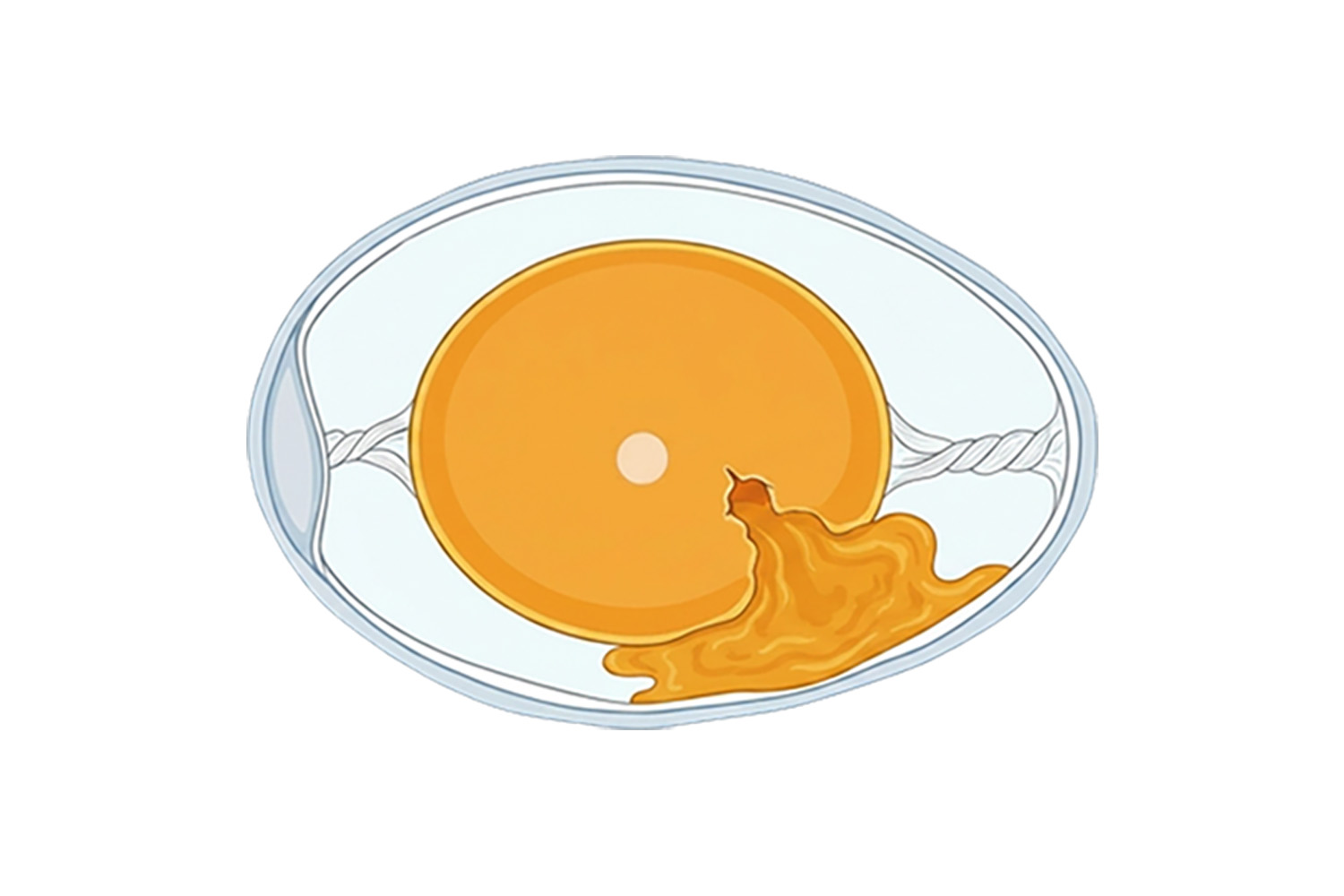 PlusVet Animal Health, feed additives, feed additives, plant extracts, essential oils, phytobiotics, phytochemicals, phytogenics, laying hens, layers, breeders, poultry, broilers, chicks, chicken, zinc, saline water, sodium chloride, egg quality, eggshell, yolk, cracked eggs, cracks, shell, laying rate, egg production, defective eggs, fractures, selenium, magnesium, manganese, zinc, LIVER, fertility